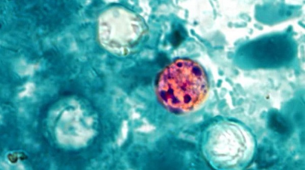Photo: CDC Consumer Advice and Public Health Warnings