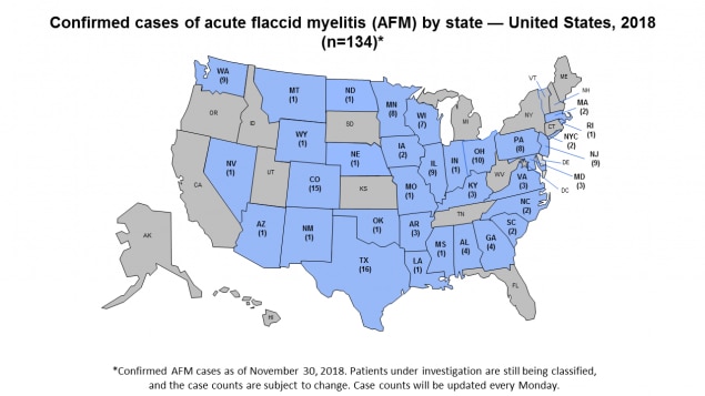 Map of US with confirmed cases of acute flaccid myelitis or AFM by state, 2018.
