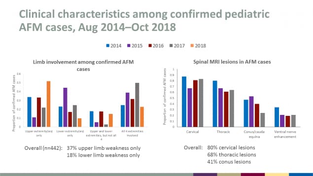 Clinical characteristics among confirmed pediatric AFM cases from August 2014 through October 2018, including limb involvement and spinal MRI lesions