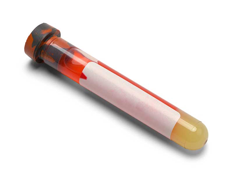 Tubo de ensayo con sangre utilizado para pruebas de laboratorio.