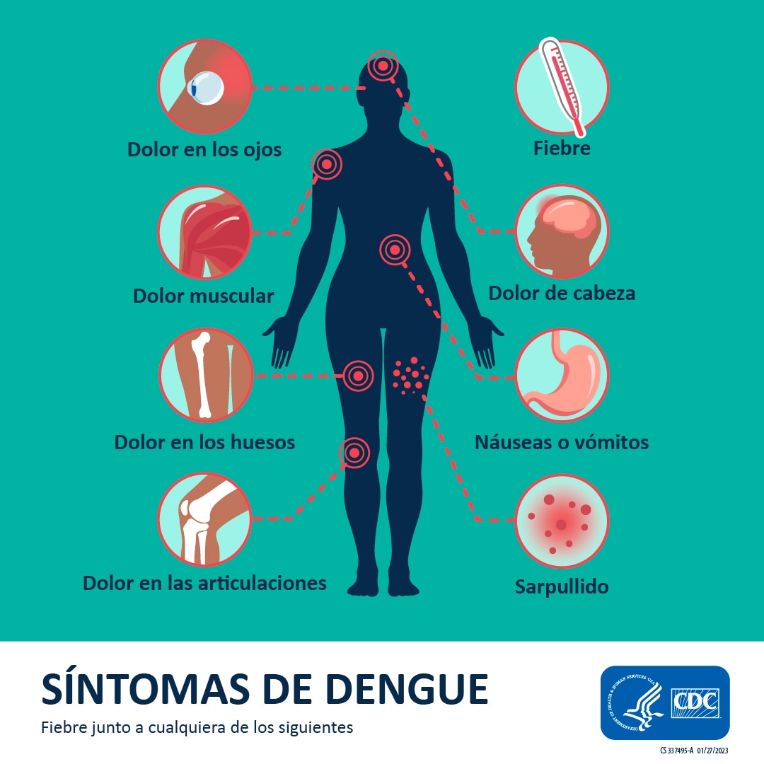 Silueta humana con gráficos y rótulos de los síntomas del dengue: dolor en los ojos, fiebre, dolores musculares, dolor de cabeza, dolor en los huesos, náuseas, vómitos, dolor en las articulaciones y sarpullido.