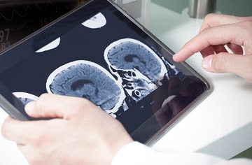 Health care professional reviewing brain scan images on a tablet.