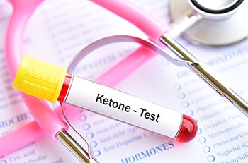Stethoscope and vial with ketone label