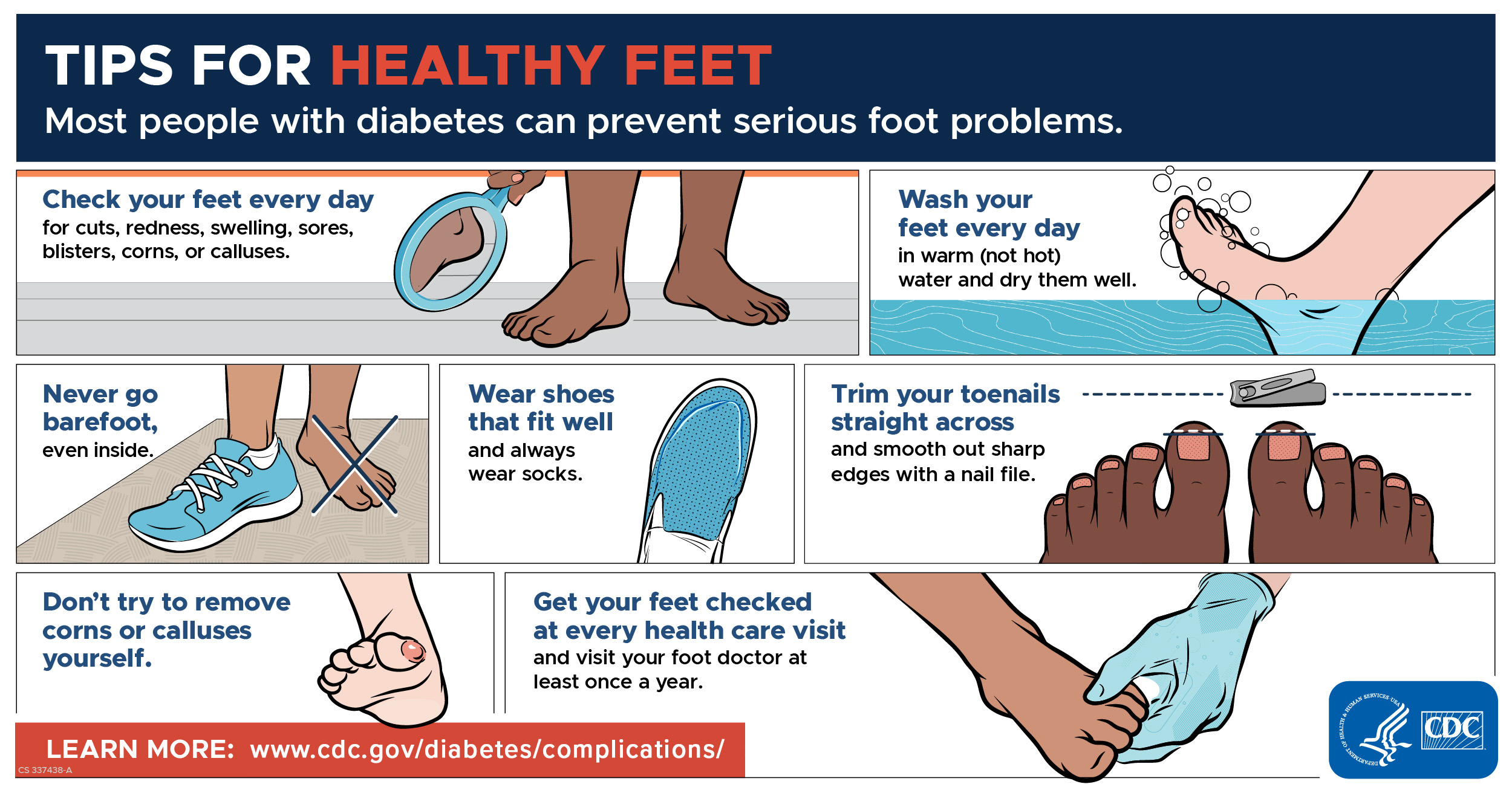 How To Take Care Of Feet Perfect Feet Care CAEQVO