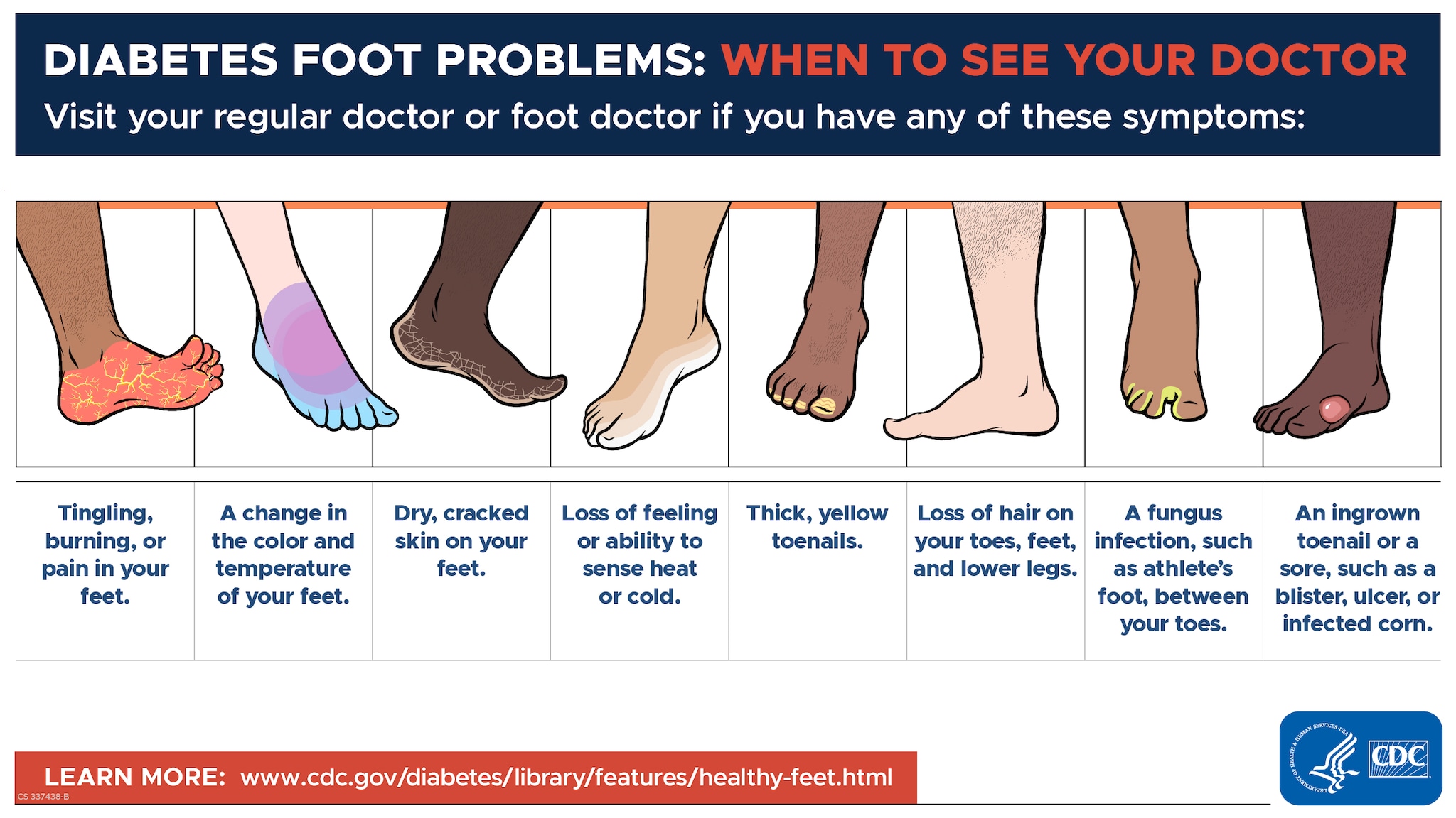 Visit your regular doctor or foot doctor if you have any of these symptoms.