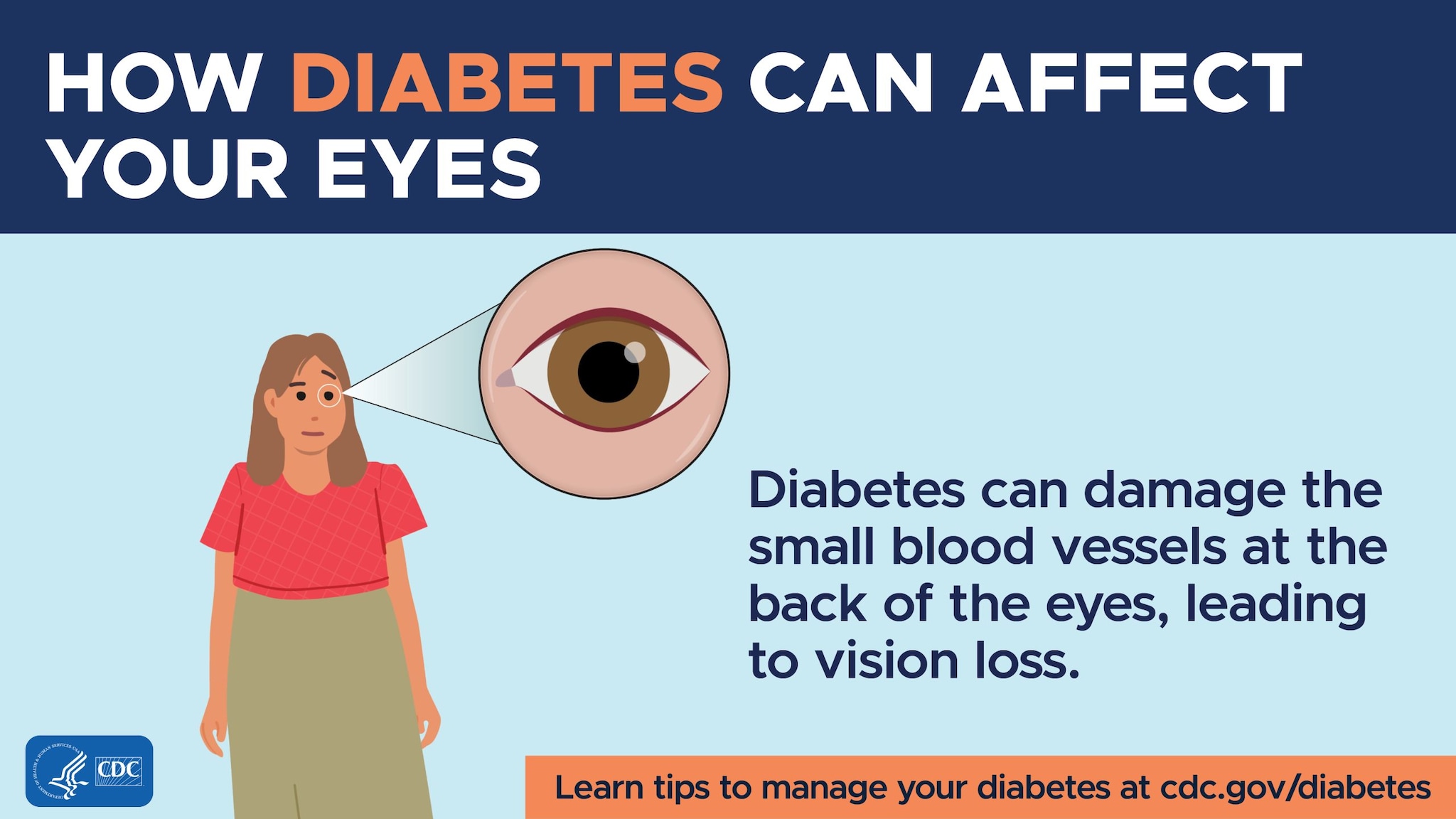 Diabetes can damage the small blood vessels at the back of the eyes, leading to vision loss.