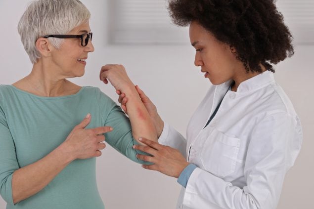 Una dermatóloga examina a una mujer mayor que tiene un sarpullido en el brazo.