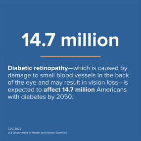Blue info card - Diabete retinopathy - which is caused by damage to small blood vessels in the back of the eye and result in vision loss