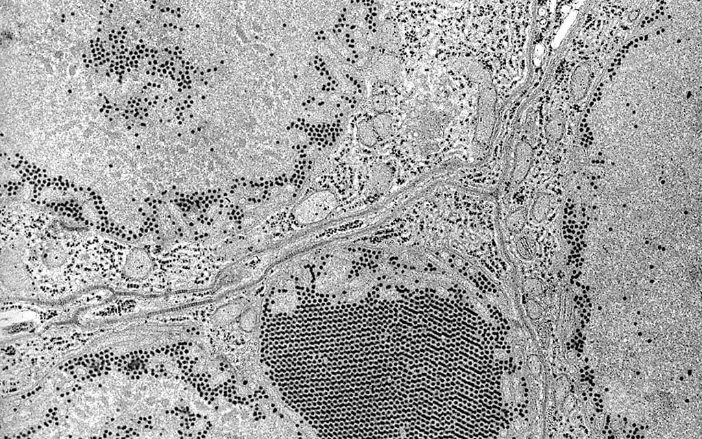 Electron micrograph of the St. Louis encephalitis virus, as seen in a mosquito salivary gland.