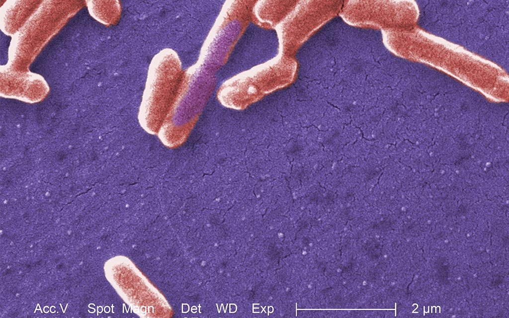 <em>E. coli</em> O157:H7 from an electron micrograph under high magnification.