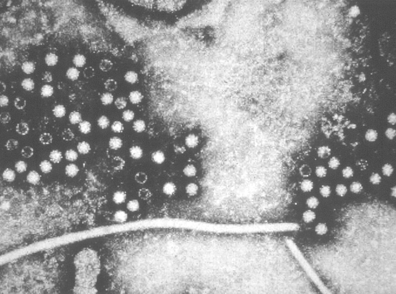 electron micrograph photo of Hepatitis E viruses