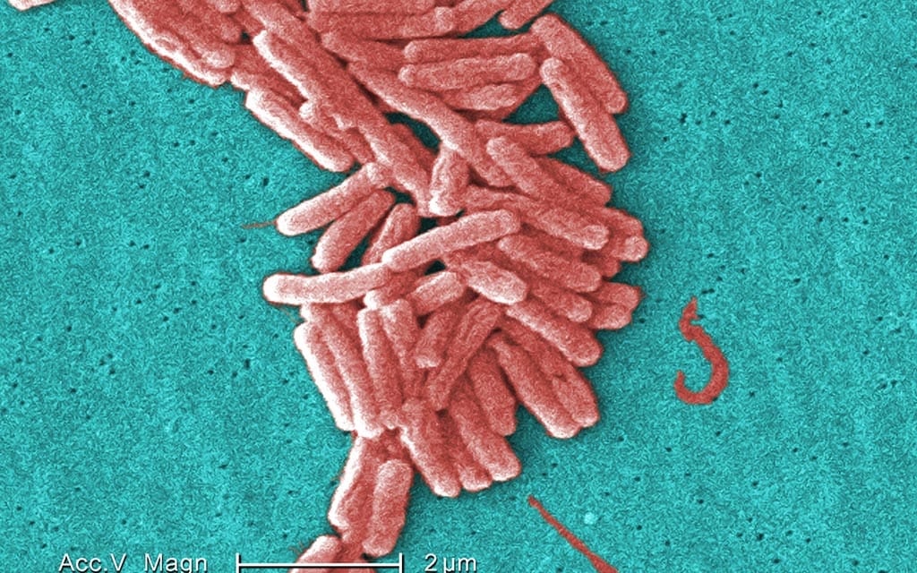 This shows a <em>Legionella pneumophila</em> (Legionnaires' disease) bacterium as seen through a scanning electron micrograph (SEM). Scientists digitally added color to this image so that the bacteria would be seen more clearly.