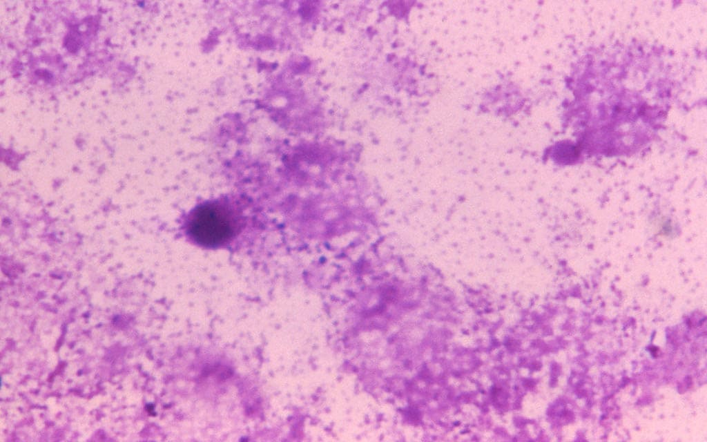 Smallpox smear under high magnification.