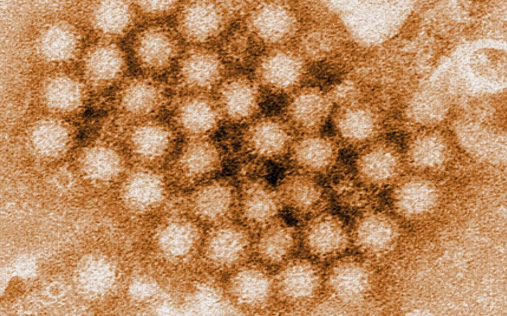 Norovirus detected by a transmission electron micrograph (TEM).