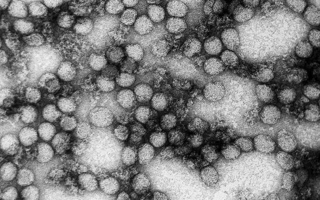 This electron micrograph shows the yellow fever virus at high magnification.