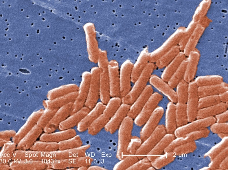 This magnified image of the <em>Salmonella</em> strain has a DNA fingerprint that looks like the strain that's infected people in 2 far-off states.