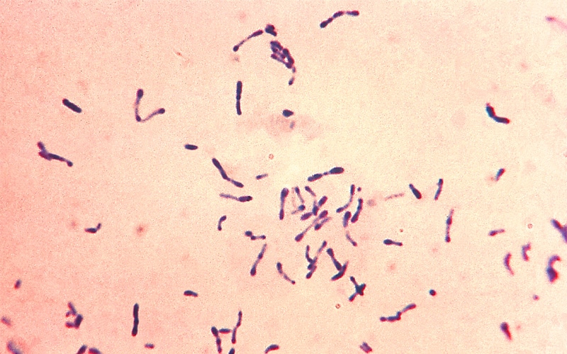 Photomicrograph depicting a number of Gram-positive Corynebacterium diphtheriae bacteria, which have been stained using the methylene blue technique. The specimen was taken from a Pai’s slant culture
