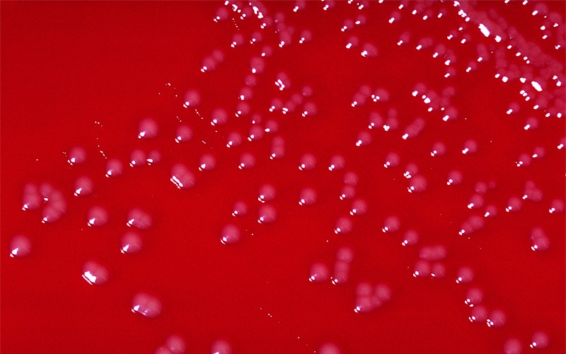 Blood agar culture with growing colonies of Corynebacterium diphtheria type (belfanti) bacteria.
