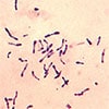 Corynebacterium diphtheriae bacteria