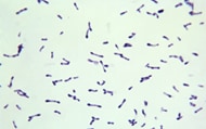 This photomicrograph shows numerous Gram-positive asporogenous, rod-shaped, Corynebacterium diphtheriae bacteria