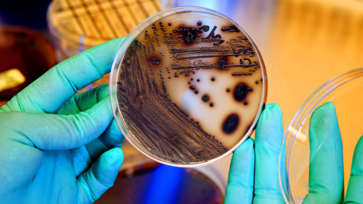 Dry Lab Pathogen CDC's Pertussis and Diphtheria Laboratory | Diphtheria | CDC