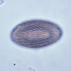 Figure C: Image of the same egg in Figure B but in a different plane of focus, showing the textured exterior.