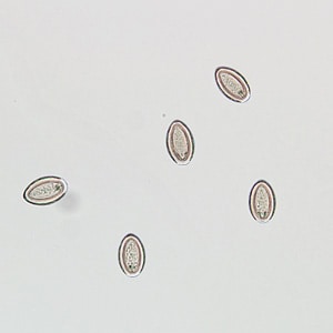 Figure A: Eggs of <em>M. moniliformis</em> liberated from an adult worm that was recovered from the stool of a patient.