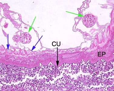 Figure B: Higher-magnification (200x) of the specimen in Figure A. Identifiable in this image are the characteristic thin cuticle (CU, black arrow), syncytial epidermis (EP), longitudinal muscles (blue arrows), and eggs (green arrows).