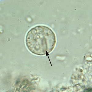 Figure B: Cyst of <em>E. histolytica/E. dispar</em> in an unstained concentrated wet mount of stool. Notice the chromatoid bodies with blunt, rounded ends (arrow).
