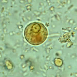 Figure C: Cyst of <em>E. histolytica/E. dispar</em> in a concentrated wet mount stained with iodine.