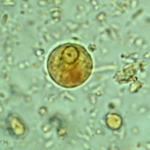 Figure C: Cyst of <em>E. histolytica/E. dispar</em> in a concentrated wet mount stained with iodine.