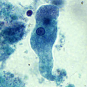 Figure A: Trophozoite of <em>E. histolytica/E. dispar</em> stained with trichrome.