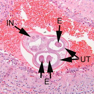 Figure B: Higher magnification of the specimen in Figure A. Notice the thick, multinucleate intestine (IN) and eggs (EG) within the uterus (UT).