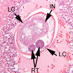 Figure D: Higher magnification of the specimen in Figure C. Shown here are the thick, multinucleate intestine (IN), reproductive tubes (RT), and lateral chords (LC).