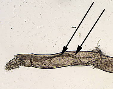 Figure B: <em>Angiostrongylus</em> worm. Note the very long spicules (black arrows), one of the indications that this is a male worm.