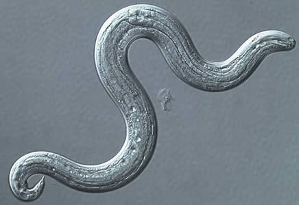 Figure B: <em>A. cantonensis</em> (L3), infective larvae recovered from a slug. Image captured under DIC microscopy.
