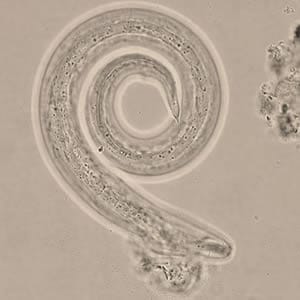 Figure C: <em>A. cantonensis</em> L3 infective larva in wet mount, recovered from slug tissue 