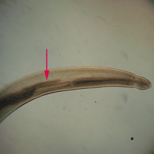 Figure C: Anterior end of <em>Pseudoterranova</em> sp.  The red arrow indicates the intestinal cecum.