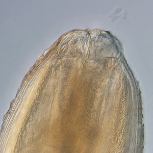 Figure B: Anterior ends of <em>Pseudoterranova</em> sp. worms; images taken at 40x and 200x magnification, respectively.