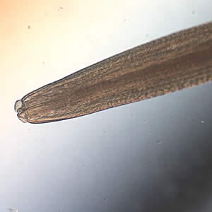Figure A: Anterior ends of <em>Pseudoterranova</em> sp. worms; images taken at 40x and 200x magnification, respectively.