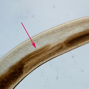 Figure D: Close-up of the intestinal cecum in the same specimen seen in Figure C