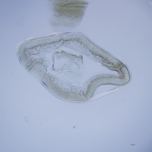Figure C: Cross-section of <em>Anisakis</em> sp., viewed under DIC microscopy.