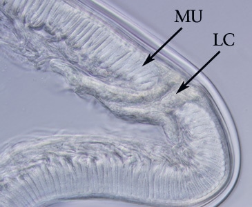 Figure D: Higher magnification of the specimen in Figure C. Note the tall, prominent muscle cells (MU) and Y-shaped lateral chords (LC), characteristic for this genus.