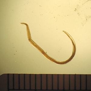 Figure B: L3 larva of an anisakid worm.