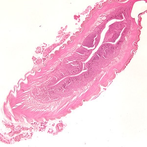 Figure A: Larva of an anisakid worm from a gastric biopsy specimen, stained with H&E. Image taken at 100x magnification.