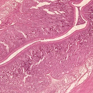 Figure C: Higher magnification (400x) of the specimen in Figures A and B, showing a close-up of the folded intestine with a brush border.