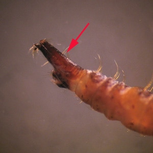 Figure E: Aquatic larvae of flies. The free-living aquatic larvae of various flies breed in standing water, including toilets, leading to the misconception they came from stool or urine. The presence of prolegs, a head capsule, breathing tubes (arrow), segmentation and/or setae will usually distinguish them from true parasitic worms.