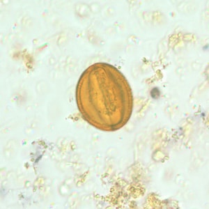 Figure C: Pollen grain in a concentrated wet mount of stool.