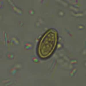 Figure B: Possible pollen grain or algal or fungal spore in a concentrated wet mount of stool. Grains like this one resemble the operculated eggs of <em>Clonorchis, Metagonimus</em> and related. These grains are usually smaller than the trematode eggs, however. Image courtesy of the Washington State Public Health Laboratories.