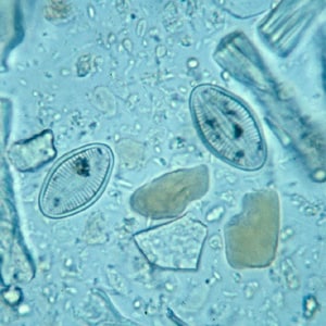 Figure E: Diatoms in stool. Diatoms do not specifically resemble any parasites of humans, but their size and shape and apparent structure may cause the microscopist to take notice.